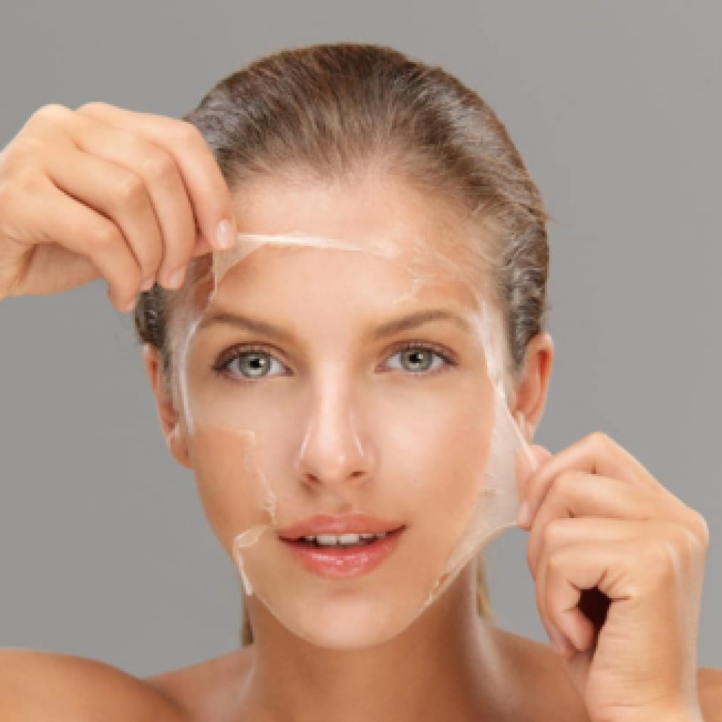 chemical-peel